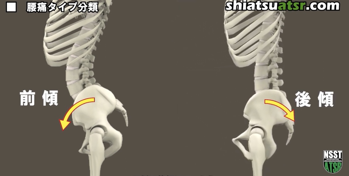 YouTubeのしあつATSRドットコムのスクリーンショット。にたいの人間の骨の骨盤のあたりをクローズアップしており、左が骨盤が前に傾いている様子、右が骨盤が後ろに傾いている様子をあらわしています